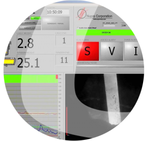 LTM Nupro Slagview